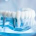 Имплантация зубов в Молдове — цены, качество, рекомендации